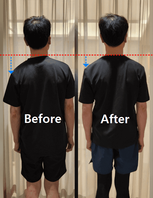 Before & After 5